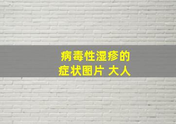 病毒性湿疹的症状图片 大人